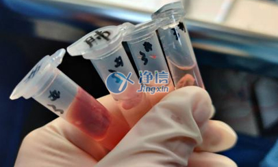 凈信全自動(dòng)樣品快速研磨儀|浙二醫(yī)院動(dòng)物內(nèi)臟組織研磨